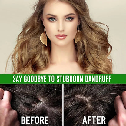 100% Pure Batana Oil from Honduras – Hair Growth & Deep Repair Treatment (2.02 fl oz)