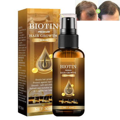 EELHOE Biotin Hair Growth Serum – Scalp Revitalizing & Follicle Strengthening Treatment (30ml)