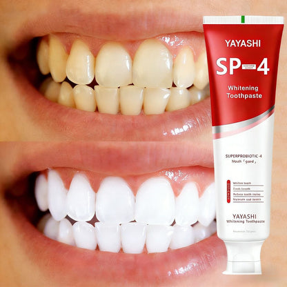 Yayashi SP-4 Ultra+ Whitening Toothpaste – Deep Clean, Stain Removal & Brilliant White Smile