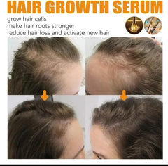 EELHOE Biotin Hair Growth Serum – Anti Hair Loss Treatment for Thicker, Stronger & Healthier Hair (30ml)