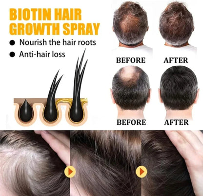 EELHOE Biotin Hair Growth Serum – Anti Hair Loss Treatment for Thicker, Stronger & Healthier Hair (30ml)