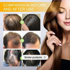 EELHOE Biotin Hair Growth Serum – Anti Hair Loss Treatment for Thicker, Stronger & Healthier Hair (30ml)