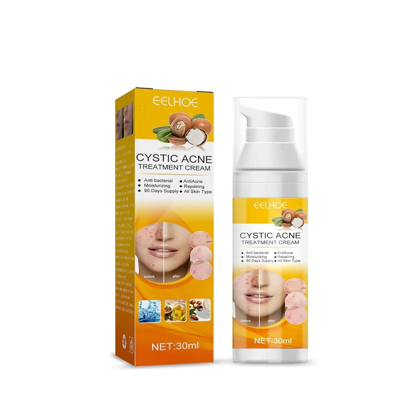 EELHOE Cystic Acne Treatment Cream – Anti-Acne, Hydrating Formula for Clear & Smooth Skin (30ml)