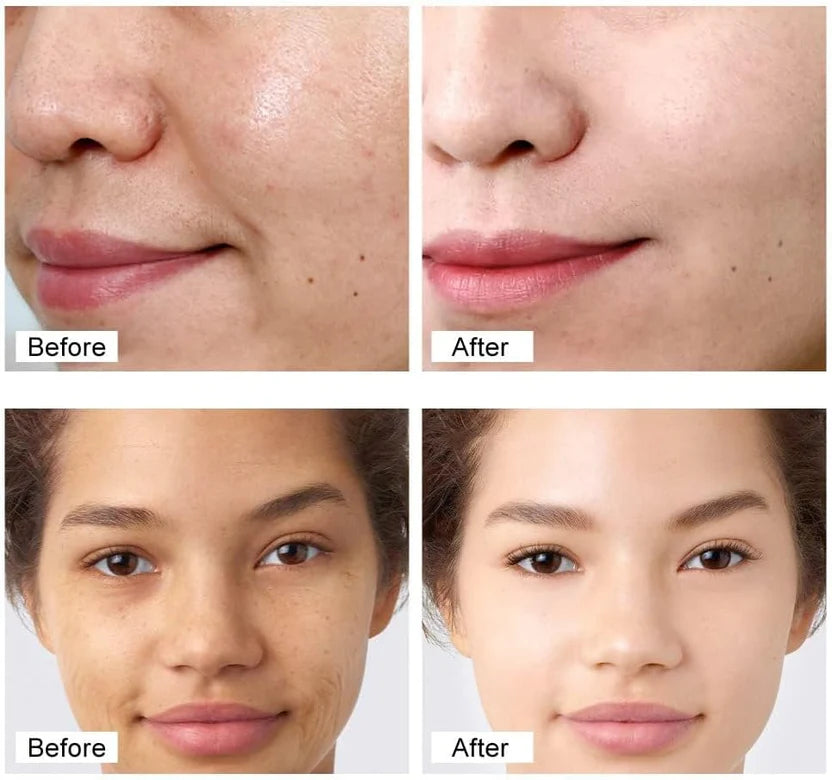 Retinol Face Cream – Whitening, Anti-Wrinkle & Deep Moisturizer for Dry Skin | Skin Firming & Rejuvenation