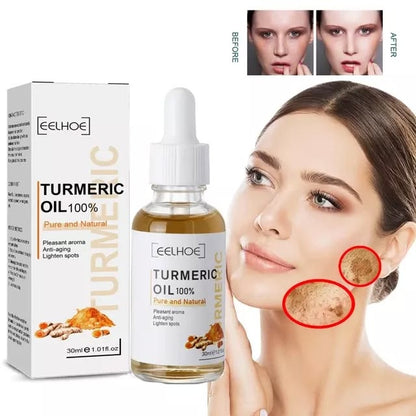 EELHOE 100% Pure Turmeric Facial Oil – Anti-Aging Serum for Dark Spots & Hyperpigmentation (30ml)